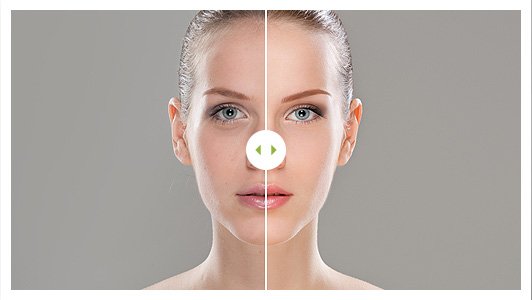 Before After Image 01