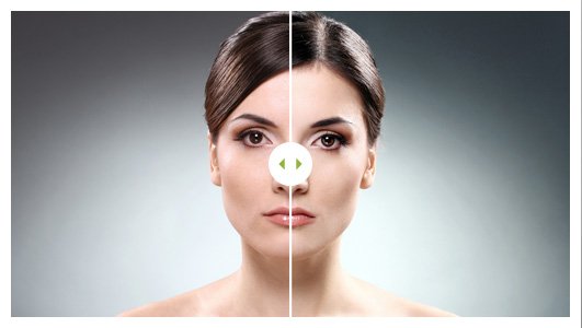 Before After Image 02