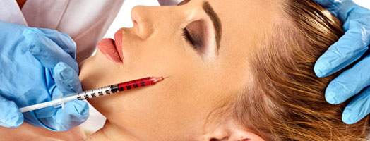 Injection Fillers