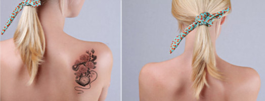 Laser tattoo removal before and after.