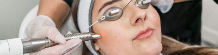 The power of IPL photo facial rejuvenation treatment in San Mateo, CA for many signs of sun damage, aging