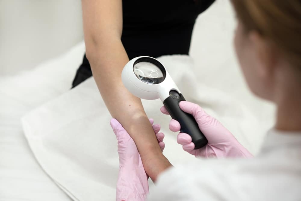 Examining a mole