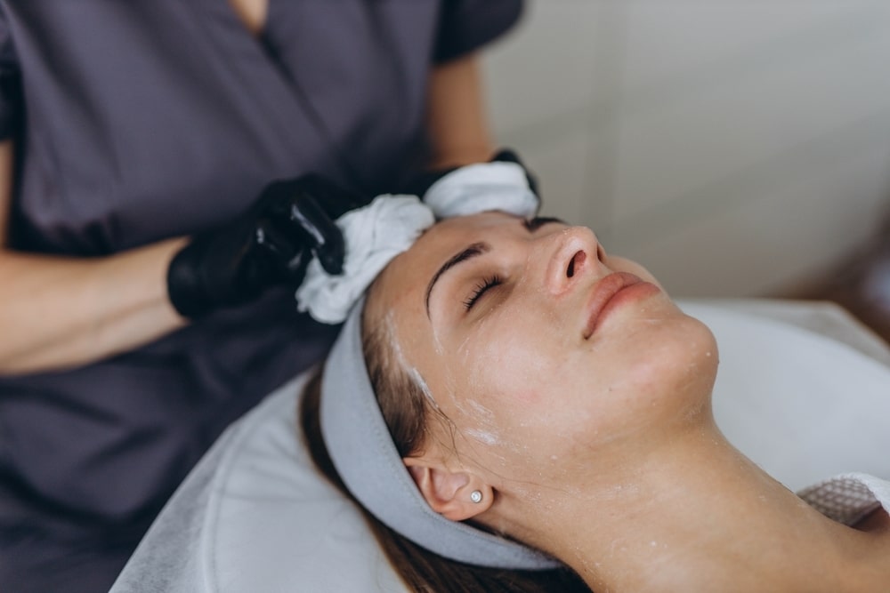 Chemical Peel