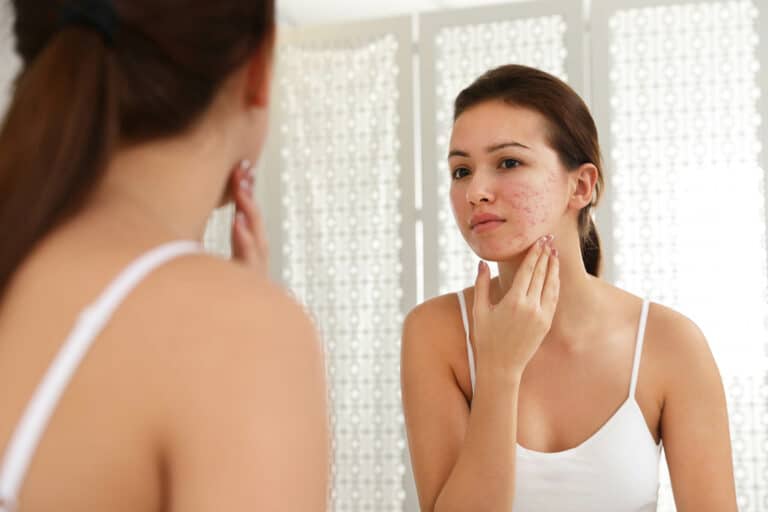 How To Improve Your Neck’s Appearance